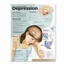 Understanding Depression