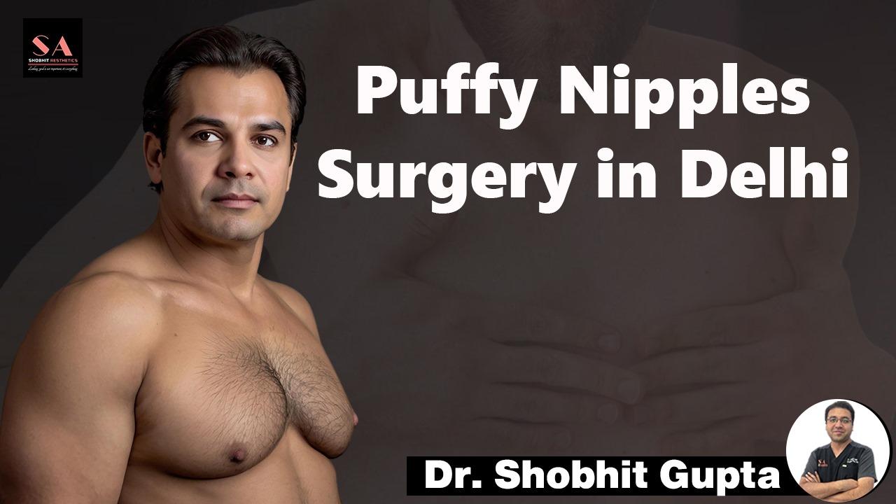 Puffy Nipple Surgery in Delhi:  Achieving a Flatter, More Defined Chest