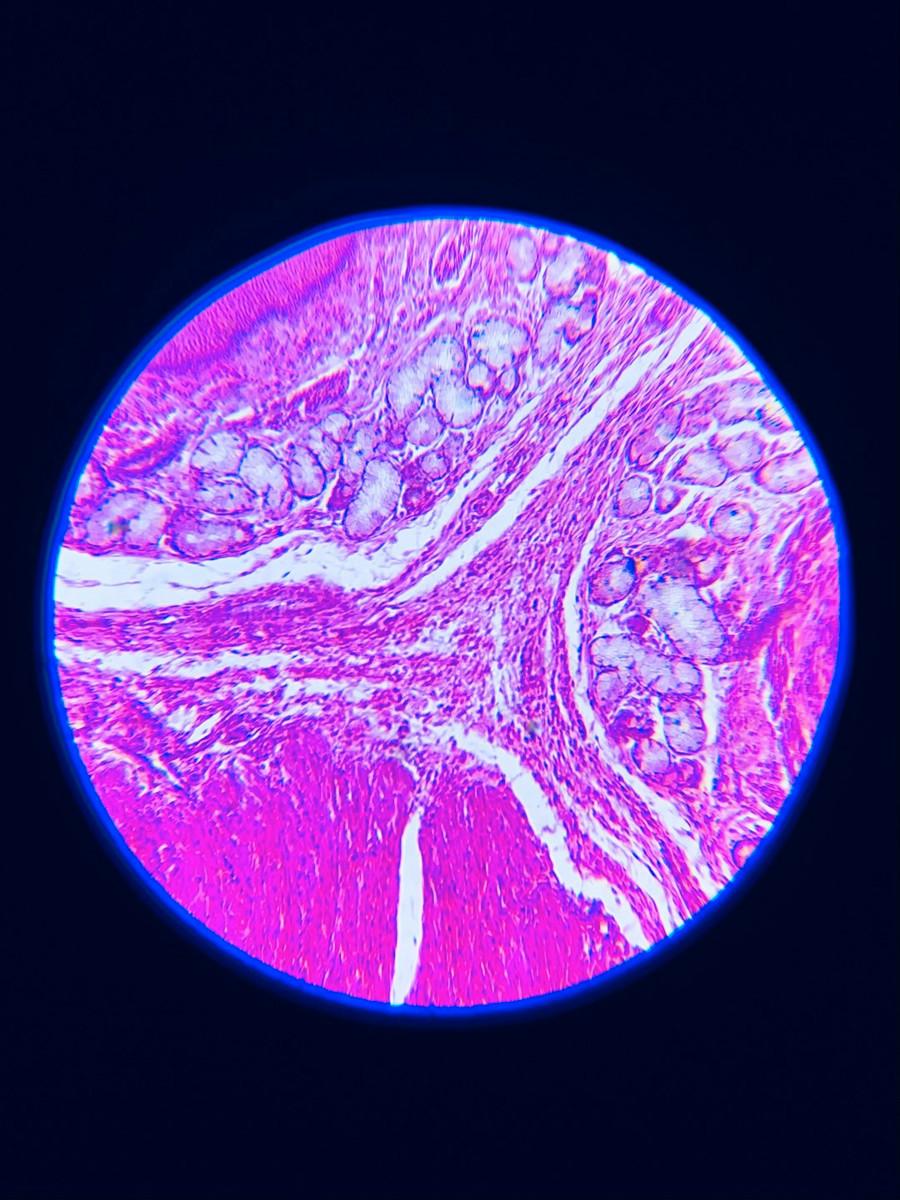 Complement Proteins