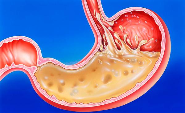 The Power of Hydrochloric Acid in Stomach