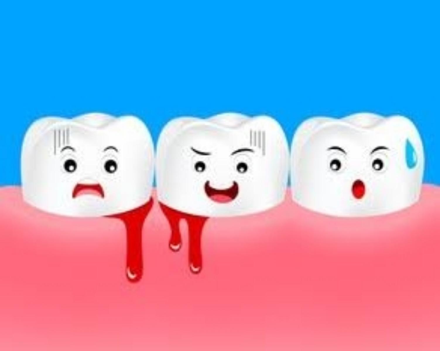 Myth 2:Bleeding gums are normal