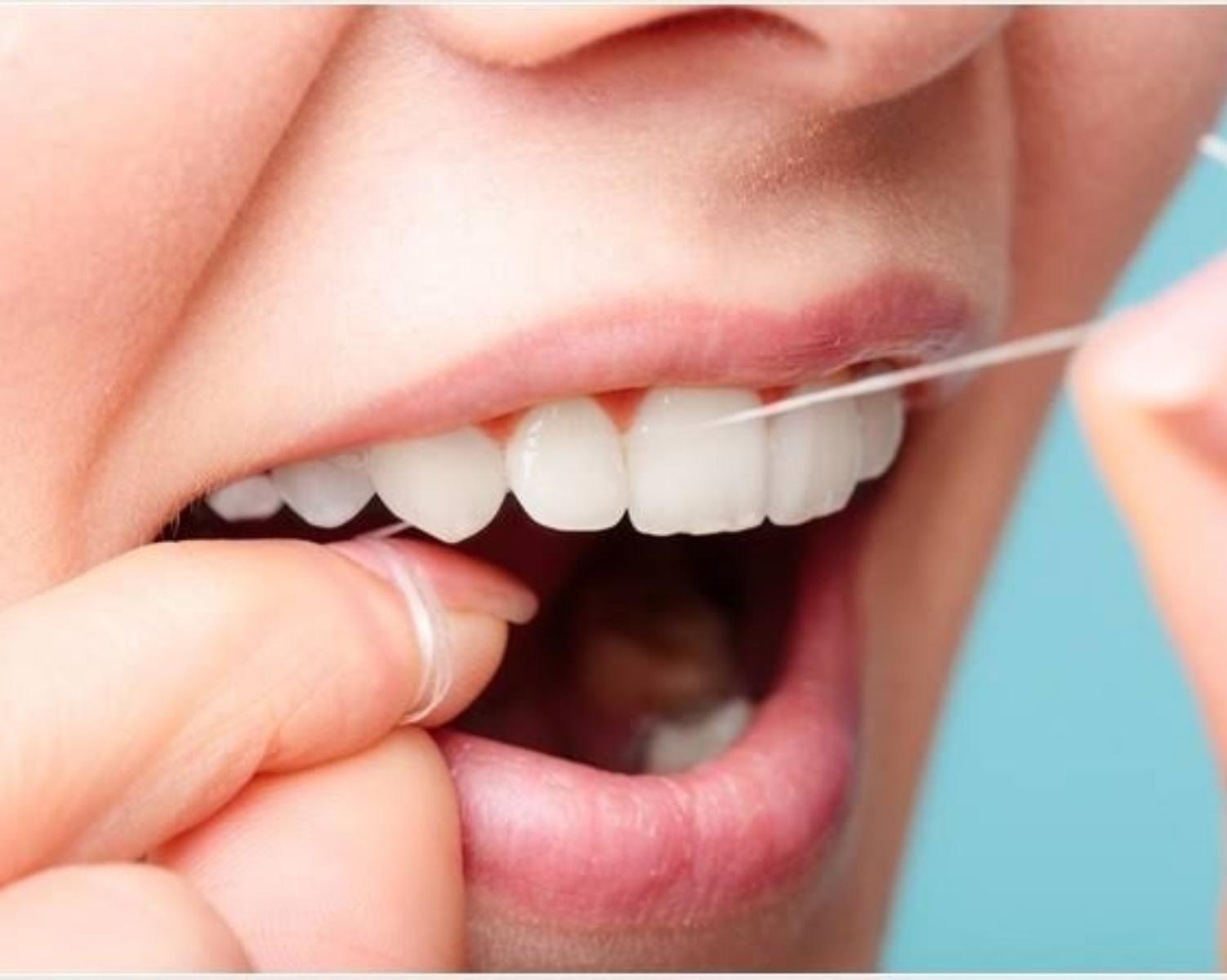 Myth 4: Flossing is really not necessary