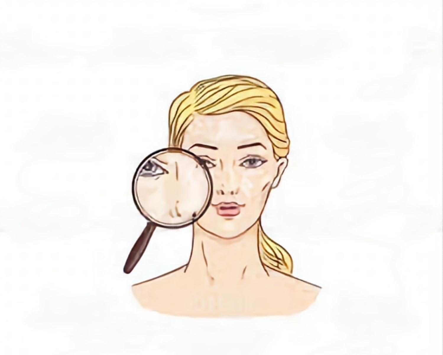 Dehydrated Oily Skin Leads To A Cycle of Excess Sebum Production