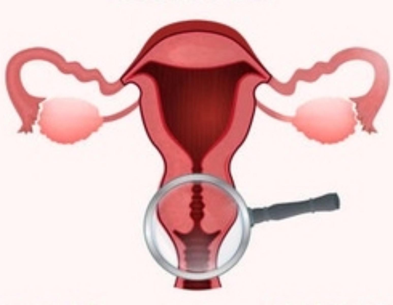 Cervical fluid