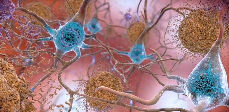 New drugs for Alzheimer's disease