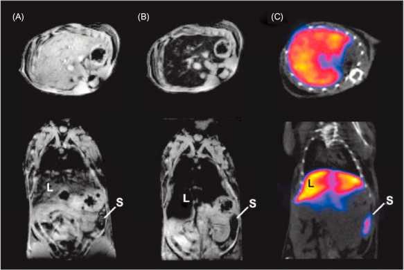Emission Computed Tomography (ECT)
