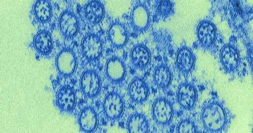 2009 H1N1 Pandemic