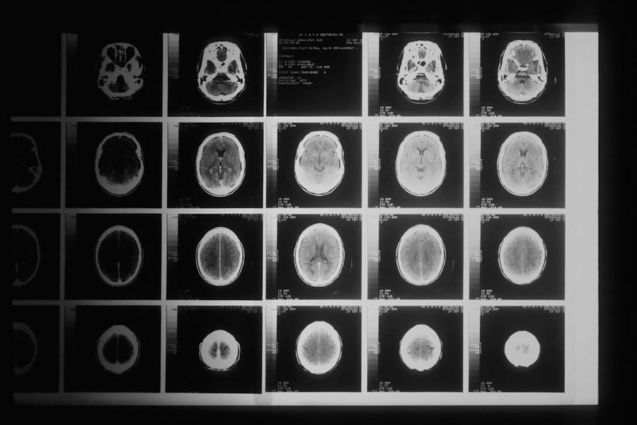 Music under fMRI.