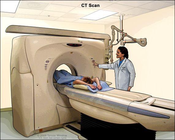 What does CT stand for in medical terms?