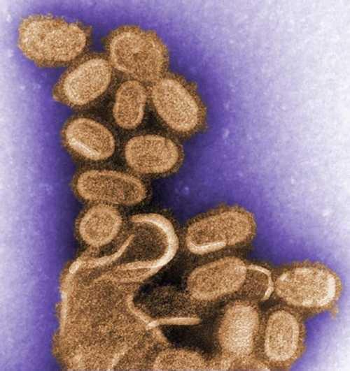 1918 Pandemic (H1N1 virus)