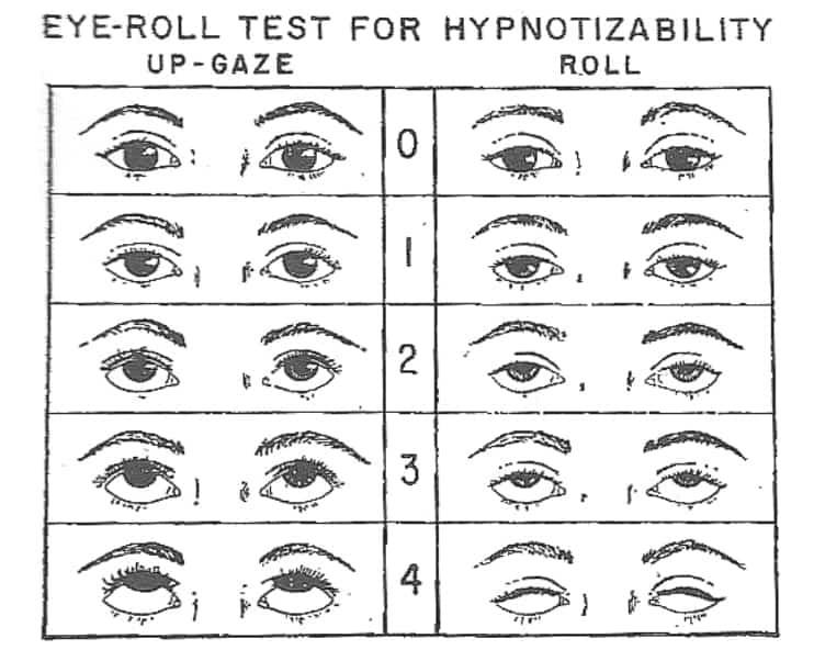 Are you hypnotizable? Try the Spiegel eye-roll test