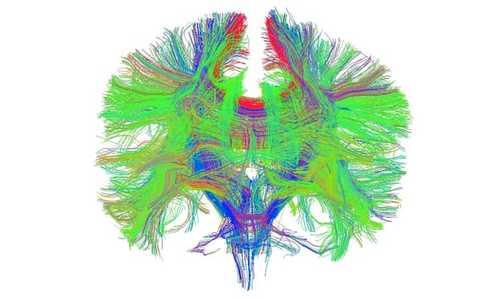 Smoking high-strength cannabis may damage nerve fibres in brain | Drugs