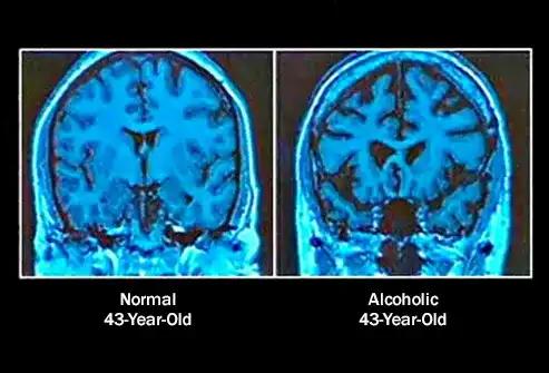 Alcohol Affects Body Mostly In A Bad Manner.